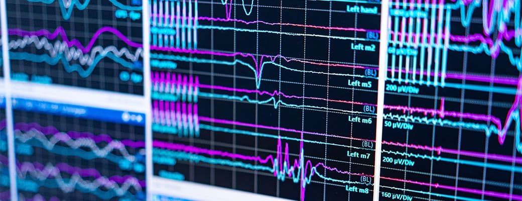 Close-up of an EEG monitor showing coloured brain-wave traces